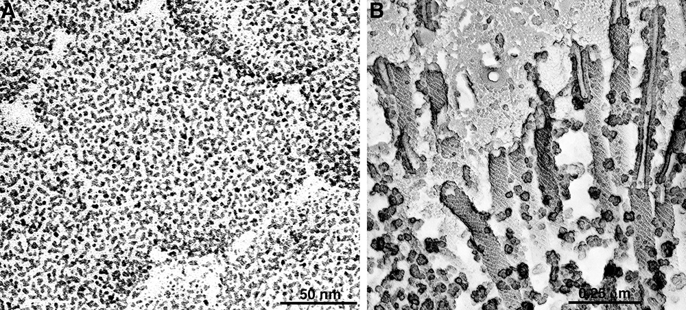 Two images show surface membrane of sarcoplasmic reticulum with a large number of calcium pump proteins, and a scallop’s muscle cell with the calcium pump proteins forming a semicrystalline arrangement